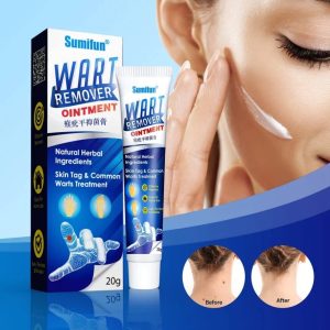 umifun Wart Remover Ointment